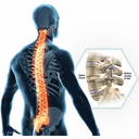 Bone Biologics Action